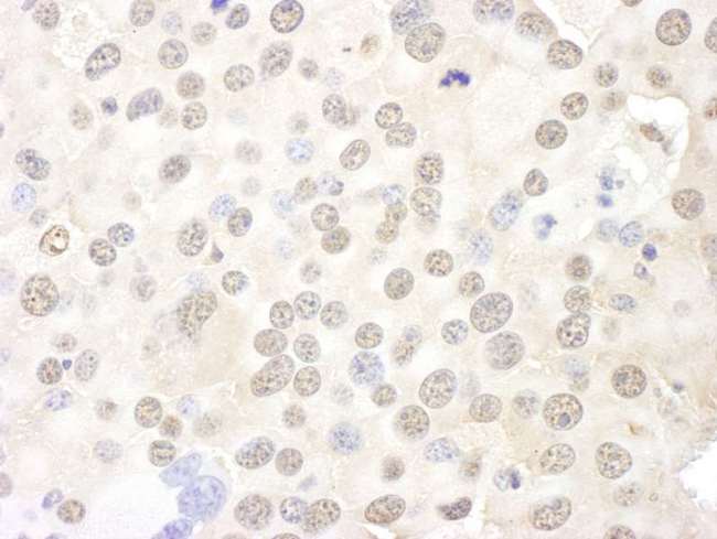 BOP1 Antibody - Detection of Mouse BOP1 by Immunohistochemistry. Sample: FFPE section of mouse renal cell carcinoma. Antibody: Affinity purified rabbit anti-BOP1 used at a dilution of 1:250.
