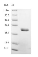 OspA Protein - (Tris-Glycine gel) Discontinuous SDS-PAGE (reduced) with 5% enrichment gel and 15% separation gel.