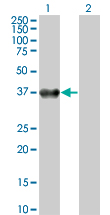 BOULE / BOLL Antibody - Western blot of BOLL expression in transfected 293T cell line by BOLL monoclonal antibody (M06), clone 2E8.