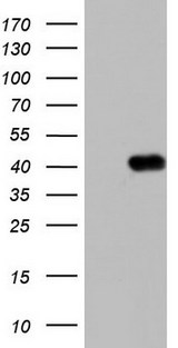 BOULE / BOLL Antibody - HEK293T cells were transfected with the pCMV6-ENTRY control (Left lane) or pCMV6-ENTRY BOLL (Right lane) cDNA for 48 hrs and lysed. Equivalent amounts of cell lysates (5 ug per lane) were separated by SDS-PAGE and immunoblotted with anti-BOLL.