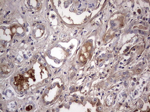 BOULE / BOLL Antibody - IHC of paraffin-embedded Human Kidney tissue using anti-BOLL mouse monoclonal antibody. (Heat-induced epitope retrieval by 1 mM EDTA in 10mM Tris, pH8.5, 120°C for 3min).