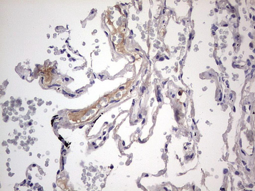 BOULE / BOLL Antibody - IHC of paraffin-embedded Human lung tissue using anti-BOLL mouse monoclonal antibody. (Heat-induced epitope retrieval by 1 mM EDTA in 10mM Tris, pH8.5, 120°C for 3min).