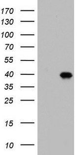 BOULE / BOLL Antibody - HEK293T cells were transfected with the pCMV6-ENTRY control. (Left lane) or pCMV6-ENTRY BOLL. (Right lane) cDNA for 48 hrs and lysed. Equivalent amounts of cell lysates. (5 ug per lane) were separated by SDS-PAGE and immunoblotted with anti-BOLL.