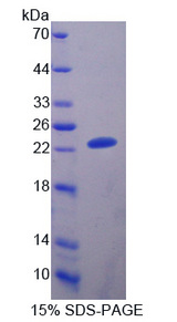 A1BG Protein - Recombinant  Alpha-1-B-Glycoprotein By SDS-PAGE