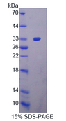 ACAN / Aggrecan Protein - Recombinant  Aggrecan By SDS-PAGE