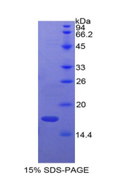 ADM / Adrenomedullin Protein - Recombinant Adrenomedullin By SDS-PAGE