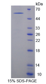 ALCAM / CD166 Protein - Recombinant  Activated Leukocyte Cell Adhesion Molecule By SDS-PAGE