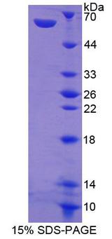 AREG / Amphiregulin Protein - Recombinant Amphiregulin By SDS-PAGE