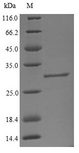 B4GALT1 Protein - (Tris-Glycine gel) Discontinuous SDS-PAGE (reduced) with 5% enrichment gel and 15% separation gel.