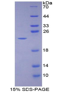 BMP3 Protein - Recombinant Bone Morphogenetic Protein 3 By SDS-PAGE