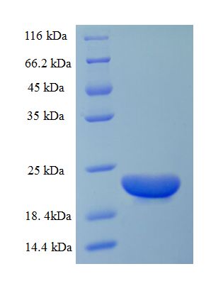 CCL20 / MIP-3-Alpha Protein