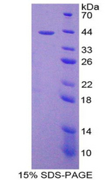 CCL8 / MCP2 Protein - Recombinant Monocyte Chemotactic Protein 2 By SDS-PAGE