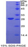 CCND1 / Cyclin D1 Protein - Recombinant Cyclin D1 By SDS-PAGE