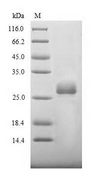 BCoV Spike Protein - (Tris-Glycine gel) Discontinuous SDS-PAGE (reduced) with 5% enrichment gel and 15% separation gel.