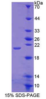 CSF3 / G-CSF Protein - Recombinant  Colony Stimulating Factor 3, Granulocyte By SDS-PAGE