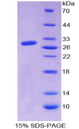 CTGF Protein - Recombinant Connective Tissue Growth Factor By SDS-PAGE