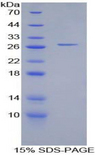 CTSS / Cathepsin S Protein - Recombinant Cathepsin S By SDS-PAGE