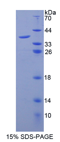CXCL6 Protein - Recombinant  Granulocyte Chemotactic Protein 2 By SDS-PAGE