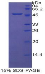 ENO1 / Alpha Enolase Protein - Recombinant Enolase, Non Neuronal By SDS-PAGE