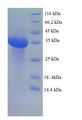 EPO / Erythropoietin Protein