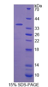 F5 / Factor Va Protein - Recombinant  Coagulation Factor V By SDS-PAGE