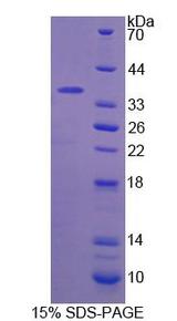 F5 / Factor Va Protein - Recombinant  Coagulation Factor V By SDS-PAGE