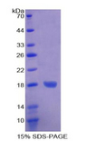FABP3 / H-FABP Protein - Recombinant Fatty Acid Binding Protein 3, Muscle And Heart By SDS-PAGE