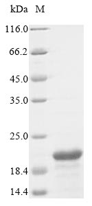 FDX1 / ADX Protein - (Tris-Glycine gel) Discontinuous SDS-PAGE (reduced) with 5% enrichment gel and 15% separation gel.