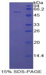 FGB / Fibrinogen Beta Chain Protein - Recombinant Fibrinogen Beta By SDS-PAGE