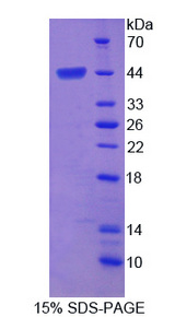FGF4 Protein - Recombinant Fibroblast Growth Factor 4 By SDS-PAGE