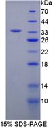 FGG / Fibrinogen Gamma Protein - Recombinant  Fibrinogen Gamma By SDS-PAGE