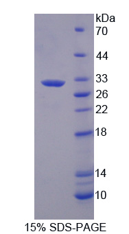 GC1qR / C1QBP Protein - Recombinant Hyaluronan Binding Protein 1 By SDS-PAGE