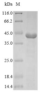 GNAT2 Protein - (Tris-Glycine gel) Discontinuous SDS-PAGE (reduced) with 5% enrichment gel and 15% separation gel.