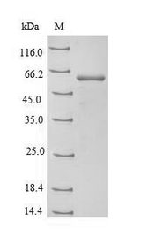 GOT2 Protein - (Tris-Glycine gel) Discontinuous SDS-PAGE (reduced) with 5% enrichment gel and 15% separation gel.