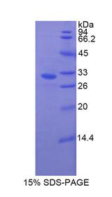 GSN / Gelsolin Protein - Recombinant Gelsolin By SDS-PAGE