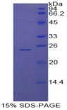 GSTP1 / GST Pi Protein - Recombinant Glutathione S Transferase Pi By SDS-PAGE