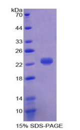 HP / Haptoglobin Protein - Recombinant Haptoglobin By SDS-PAGE