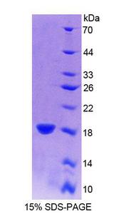 IFN Gamma / Interferon Gamma Protein - Recombinant Interferon Gamma By SDS-PAGE
