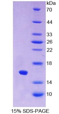IFNA / Interferon Alpha Protein - Recombinant  Interferon Alpha By SDS-PAGE