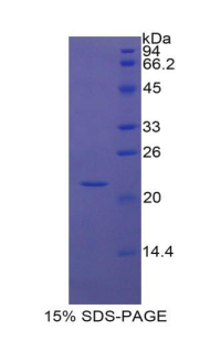 IGFBP1 Protein - Recombinant Insulin Like Growth Factor Binding Protein 1 By SDS-PAGE