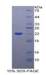 IL-10 Protein - Recombinant Interleukin 10 By SDS-PAGE