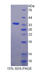 IL-1B / IL-1 Beta Protein - Recombinant  Interleukin 1 Beta By SDS-PAGE