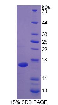 IL2 Protein - Recombinant  Interleukin 2 By SDS-PAGE