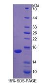 IL2 Protein - Recombinant  Interleukin 2 By SDS-PAGE