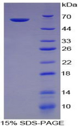 ITGA5/Integrin Alpha 5/CD49e Protein - Recombinant Integrin Alpha 5 By SDS-PAGE
