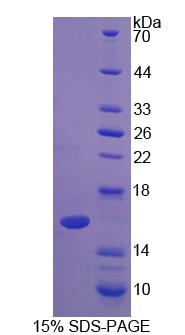 LALBA / Alpha Lactalbumin Protein - Recombinant  Alpha-Lactalbumin By SDS-PAGE