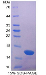 LGALS1 / Galectin 1 Protein - Recombinant Galectin 1 By SDS-PAGE