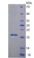 MUC5B Protein - Recombinant  Mucin 5 Subtype B By SDS-PAGE