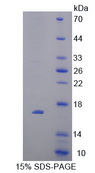 P450SCC / CYP11A1 Protein - Recombinant  Cytochrome P450 11A1 By SDS-PAGE