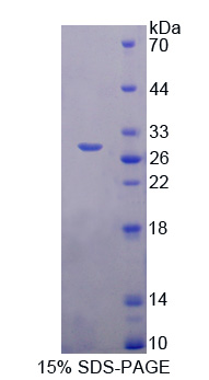 PRDX6 / Peroxiredoxin 6 Protein - Recombinant  Peroxiredoxin 6 By SDS-PAGE